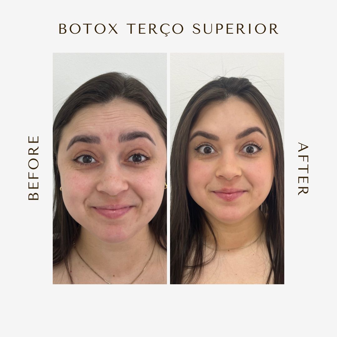 Harmonização do olhar